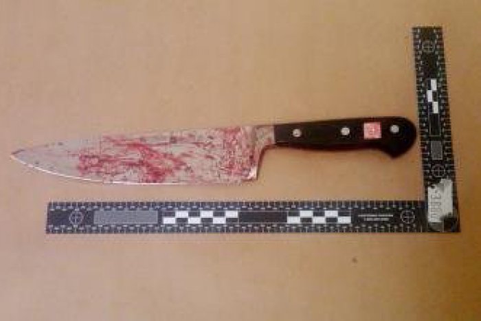 Ilustračný obrázok k článku Napadnutie nožom v Čadci: Útočník spôsobil mužovi (41) ťažké zranenia!