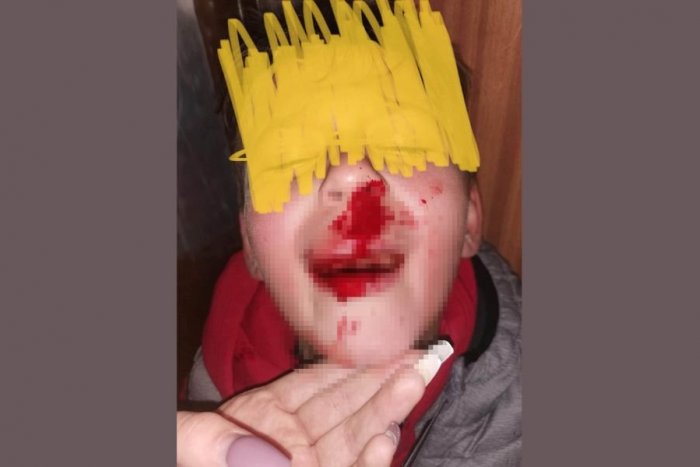 Ilustračný obrázok k článku Arogantný vodič v Žiline zrazil malého chlapca a UŠIEL: Zúfalá matka prosí o pomoc